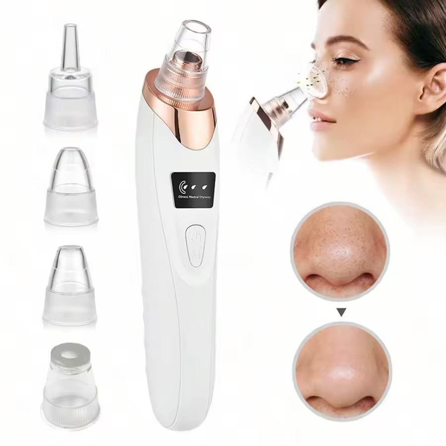 Effective Vacuum Pore Cleaner – Blackhead Remover & Facial Skin Care Device for Clear, Smooth Skin