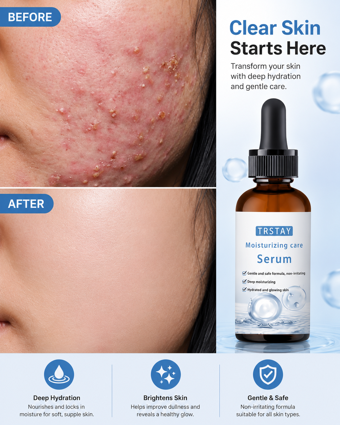 Hydrating Facial Repair Serum for Smooth & Clear Skin - UltraChic
