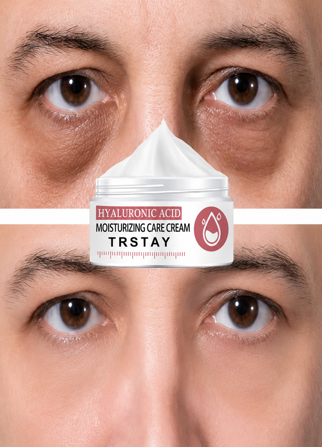 Hyaluronic Eye Repair Cream for Puffiness & Dark Circles - UltraChic