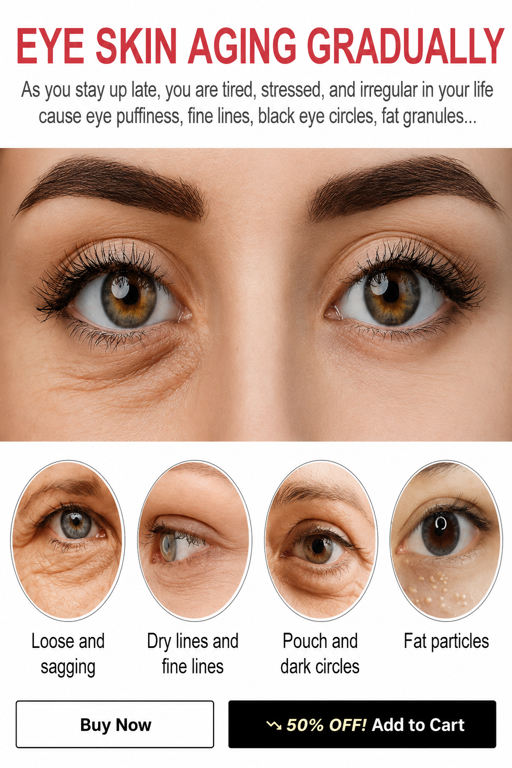 Hyaluronic Eye Repair Cream for Puffiness & Dark Circles - UltraChic