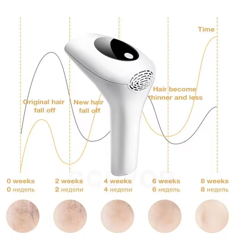 At-Home Laser Hair Removal Device – Painless, Long-Lasting Hair Removal for Smooth Skin