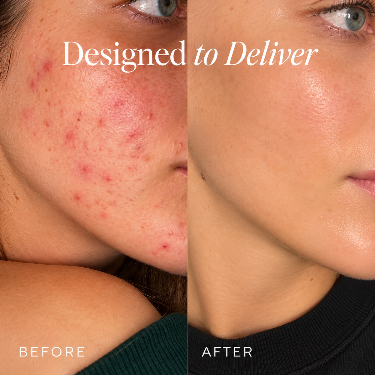 DIME Beauty The Works Discovery Set – 6-Piece Skincare Routine Kit