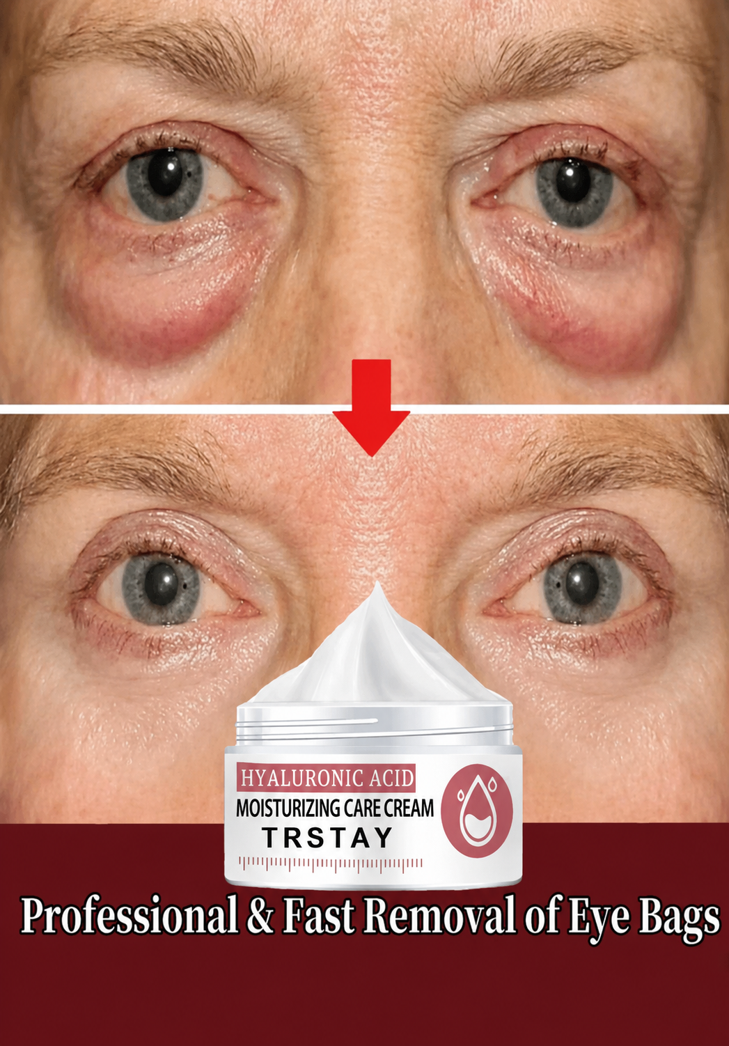 Hyaluronic Eye Repair Cream for Puffiness & Dark Circles - UltraChic