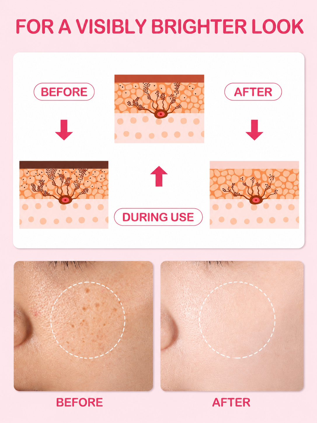 GlowFade Dark Spot Correcting Cream - UltraChic