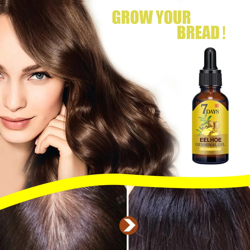EELHOE Ginger Essence Hair Growth Oil – Stimulate Hair Growth, Strengthen and Nourish for Healthier, Thicker Hair
