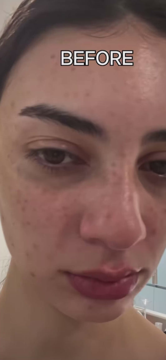 GlowFade Dark Spot Correcting Cream