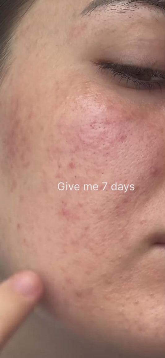 Hydrating Facial Repair Serum for Smooth & Clear Skin