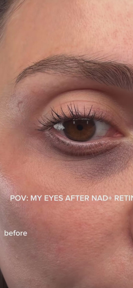 Hyaluronic Eye Repair Cream for Puffiness & Dark Circles